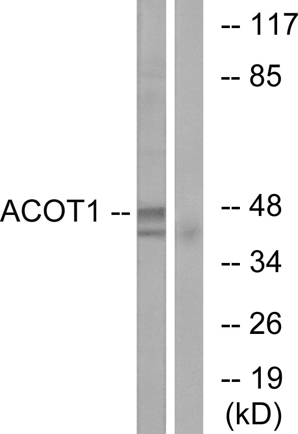 ACOT1 Antibody - Western blot analysis of lysates from Jurkat cells, using ACOT1 Antibody. The lane on the right is blocked with the synthesized peptide.