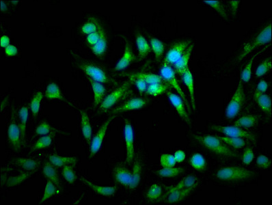 ACOT1 Antibody - Immunofluorescence staining of Hela cells at a dilution of 1:100, counter-stained with DAPI. The cells were fixed in 4% formaldehyde, permeabilized using 0.2% Triton X-100 and blocked in 10% normal Goat Serum. The cells were then incubated with the antibody overnight at 4 °C.The secondary antibody was Alexa Fluor 488-congugated AffiniPure Goat Anti-Rabbit IgG (H+L) .