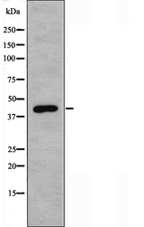 ACOT1 Antibody - Western blot analysis of extracts of Jurkat cells using ACOT1 antibody.