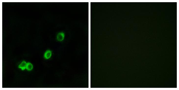 ACOT1 Antibody - Peptide - + Immunofluorescence analysis of MCF-7 cells, using ACOT1 antibody.