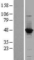 ACOT1 Protein - Western validation with an anti-DDK antibody * L: Control HEK293 lysate R: Over-expression lysate