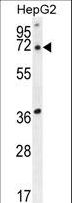 ACOT11 / THEA Antibody - ACOT11 Antibody western blot of HepG2 cell line lysates (35 ug/lane). The ACOT11 antibody detected the ACOT11 protein (arrow).