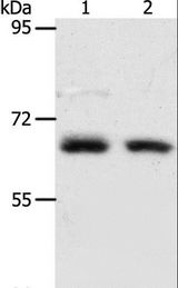 ACOT11 / THEA Antibody - Western blot analysis of Human fetal kidney and fetal lung tissue, using ACOT11 Polyclonal Antibody at dilution of 1:450.