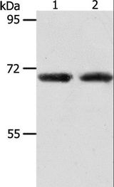 ACOT11 / THEA Antibody - Western blot analysis of Human liver cancer and fetal kidney tissue, using ACOT11 Polyclonal Antibody at dilution of 1:650.