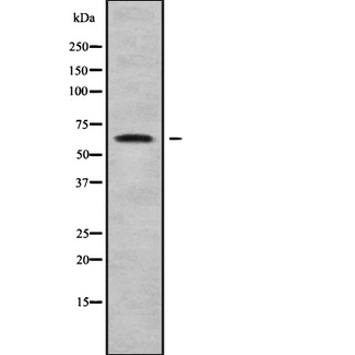 ACOT11 / THEA Antibody - Western blot analysis of ACOT11 using A549 whole cells lysates