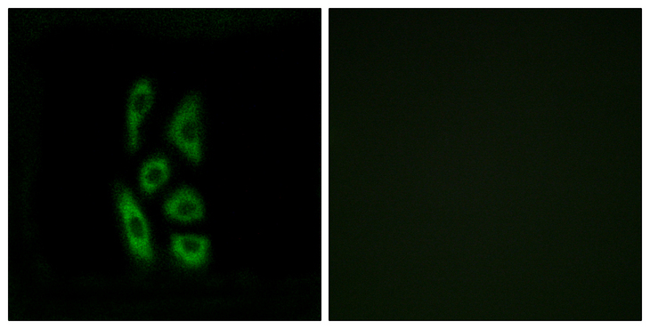 ACOT12 Antibody - Immunofluorescence analysis of A549 cells, using ACOT12 Antibody. The picture on the right is blocked with the synthesized peptide.