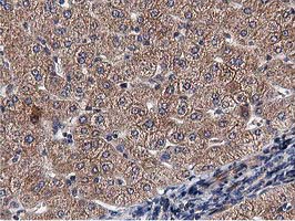 ACOT12 Antibody - IHC of paraffin-embedded Human liver tissue using anti-ACOT12 mouse monoclonal antibody.