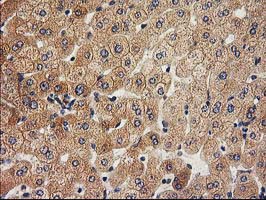 ACOT12 Antibody - IHC of paraffin-embedded Human liver tissue using anti-ACOT12 mouse monoclonal antibody.