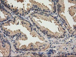 ACOT12 Antibody - IHC of paraffin-embedded Human prostate tissue using anti-ACOT12 mouse monoclonal antibody.