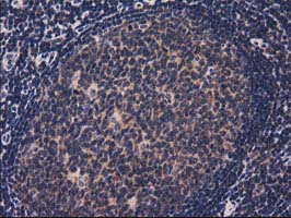 ACOT12 Antibody - IHC of paraffin-embedded Human lymph node tissue using anti-ACOT12 mouse monoclonal antibody.
