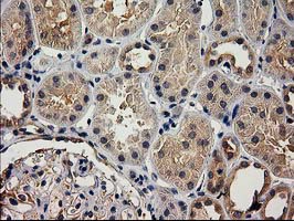 ACOT12 Antibody - IHC of paraffin-embedded Human Kidney tissue using anti-ACOT12 mouse monoclonal antibody.