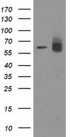 ACOT12 Antibody - HEK293T cells were transfected with the pCMV6-ENTRY control (Left lane) or pCMV6-ENTRY ACOT12 (Right lane) cDNA for 48 hrs and lysed. Equivalent amounts of cell lysates (5 ug per lane) were separated by SDS-PAGE and immunoblotted with anti-ACOT12.