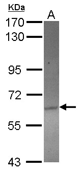 ACOT12 Antibody - Sample (30 ug of whole cell lysate) A: HeLa 7.5% SDS PAGE ACOT12 antibody diluted at 1:1000