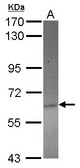 ACOT12 Antibody - Sample (30 ug of whole cell lysate) A: HeLa 7.5% SDS PAGE ACOT12 antibody diluted at 1:1000