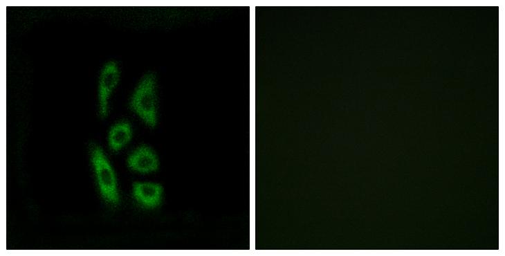 ACOT12 Antibody - Peptide - + Immunofluorescence analysis of A549 cells, using ACOT12 antibody.