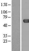 ACOT12 Protein - Western validation with an anti-DDK antibody * L: Control HEK293 lysate R: Over-expression lysate