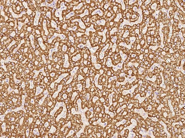 ACOT13 / THEM2 Antibody - Immunochemical staining of human THEM2 in human liver with rabbit polyclonal antibody at 1:1000 dilution, formalin-fixed paraffin embedded sections.