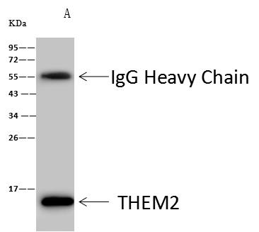ACOT13 / THEM2 Antibody - THEM2 was immunoprecipitated using: Lane A: 0.5 mg Mouse liver tissue lysate. 4 uL anti-THEM2 rabbit polyclonal antibody and 60 ug of Immunomagnetic beads Protein A/G. Primary antibody: Anti-THEM2 rabbit polyclonal antibody, at 1:100 dilution. Secondary antibody: Goat Anti-Rabbit IgG (H+L)/HRP at 1/10000 dilution. Developed using the ECL technique. Performed under reducing conditions. Predicted band size: 15 kDa. Observed band size: 15 kDa.
