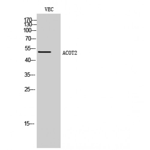ACOT2 Antibody - Western blot of ACOT2 antibody