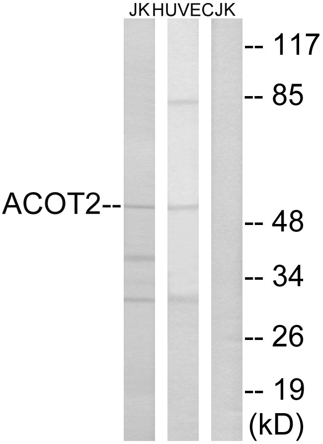 ACOT2 Antibody - Western blot analysis of lysates from Jurkat and HUVEC cells, using ACOT2 Antibody. The lane on the right is blocked with the synthesized peptide.