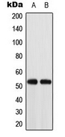 ACOT2 Antibody - Western blot analysis of ACOT2 expression in K562 (A); HT29 (B) whole cell lysates.