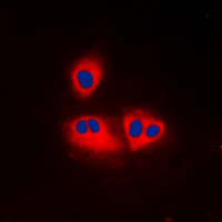 ACOT2 Antibody - Immunofluorescent analysis of ACOT2 staining in K562 cells. Formalin-fixed cells were permeabilized with 0.1% Triton X-100 in TBS for 5-10 minutes and blocked with 3% BSA-PBS for 30 minutes at room temperature. Cells were probed with the primary antibody in 3% BSA-PBS and incubated overnight at 4 C in a humidified chamber. Cells were washed with PBST and incubated with a DyLight 594-conjugated secondary antibody (red) in PBS at room temperature in the dark. DAPI was used to stain the cell nuclei (blue).