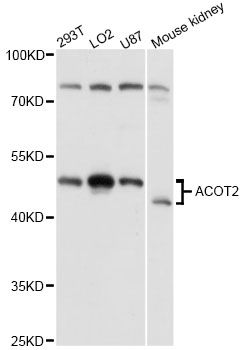ACOT2 Antibody - Western blot analysis of extracts of various cell lines, using ACOT2 antibody at 1:3000 dilution. The secondary antibody used was an HRP Goat Anti-Rabbit IgG (H+L) at 1:10000 dilution. Lysates were loaded 25ug per lane and 3% nonfat dry milk in TBST was used for blocking. An ECL Kit was used for detection and the exposure time was 10s.