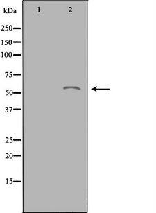 ACOT2 Antibody - Western blot analysis of extracts of Jurkat cells using ACOT2 antibody. The lane on the left is treated with the antigen-specific peptide.