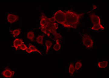ACOT2 Antibody - Staining HeLa cells by IF/ICC. The samples were fixed with PFA and permeabilized in 0.1% Triton X-100, then blocked in 10% serum for 45 min at 25°C. The primary antibody was diluted at 1:200 and incubated with the sample for 1 hour at 37°C. An Alexa Fluor 594 conjugated goat anti-rabbit IgG (H+L) Ab, diluted at 1/600, was used as the secondary antibody.