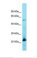 ACOT4 Antibody - Western blot of Human Lymph Node Tumor. ACOT4 antibody dilution 1.0 ug/ml.  This image was taken for the unconjugated form of this product. Other forms have not been tested.