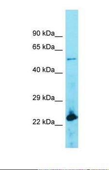 ACOT4 Antibody - Western blot of Human Lymph Node Tumor. ACOT4 antibody dilution 1.0 ug/ml.  This image was taken for the unconjugated form of this product. Other forms have not been tested.