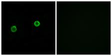 ACOT4 Antibody - Immunofluorescence analysis of MCF7 cells, using ACOT4 Antibody. The picture on the right is blocked with the synthesized peptide.