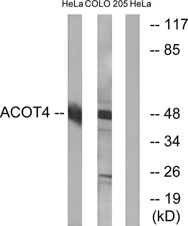 ACOT4 Antibody - Western blot analysis of lysates from HeLa and COLO cells, using ACOT4 Antibody. The lane on the right is blocked with the synthesized peptide.