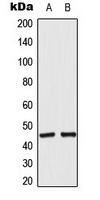 ACOT4 Antibody - Western blot analysis of ACOT4 expression in RT4 (A); A549 (B) whole cell lysates.