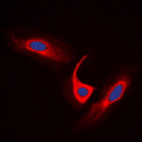 ACOT4 Antibody - Immunofluorescent analysis of ACOT4 staining in A549 cells. Formalin-fixed cells were permeabilized with 0.1% Triton X-100 in TBS for 5-10 minutes and blocked with 3% BSA-PBS for 30 minutes at room temperature. Cells were probed with the primary antibody in 3% BSA-PBS and incubated overnight at 4 C in a humidified chamber. Cells were washed with PBST and incubated with a DyLight 594-conjugated secondary antibody (red) in PBS at room temperature in the dark. DAPI was used to stain the cell nuclei (blue).