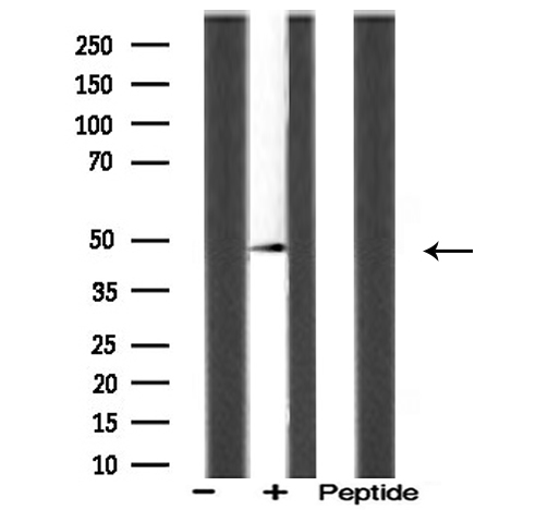 ACOT4 Antibody - Western blot analysis of ACOT4 antibody expression in mouse brain tissue lysates. The lane on the right is treated with the antigen-specific peptide.