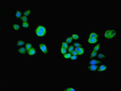 ACOT6 Antibody - Immunofluorescent analysis of PC-3 cells using ACOT6 Antibody at dilution of 1:100 and Alexa Fluor 488-congugated AffiniPure Goat Anti-Rabbit IgG(H+L)