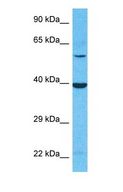 ACOT7 / BACH Antibody - Western blot of ACOT7 Antibody with human 786-0 Whole Cell lysate.  This image was taken for the unconjugated form of this product. Other forms have not been tested.