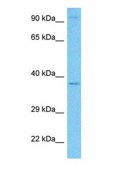 ACOT7 / BACH Antibody - Western blot of BACH Antibody with human 293T Whole Cell lysate.  This image was taken for the unconjugated form of this product. Other forms have not been tested.