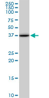 ACOT7 / BACH Antibody - ACOT7 monoclonal antibody (M02), clone 1E7. Western blot of ACOT7 expression in Jurkat.