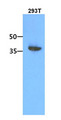ACOT7 / BACH Antibody - Western Blot: The 293T cell lysate (30 ug) were resolved by SDS-PAGE, transferred to PVDF membrane and probed with anti-human ACOT7 antibody (1:1000). Proteins were visualized using a goat anti-mouse secondary antibody conjugated to HRP and an ECL detection system.