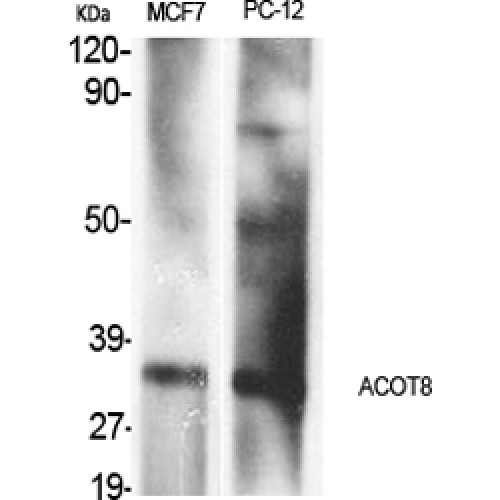 ACOT8 Antibody - Western blot of ACOT8 antibody