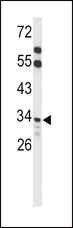 ACOT8 Antibody - Western blot of ACOT8 Antibody in mouse liver tissue lysates (35 ug/lane). ACOT8 (arrow) was detected using the purified antibody.