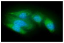 ACOT8 Antibody - ICC/IF analysis of ACOT8 in A549 cells line, stained with DAPI (Blue) for nucleus staining and monoclonal anti-human ACOT8 antibody (1:100) with goat anti-mouse IgG-Alexa fluor 488 conjugate (Green).