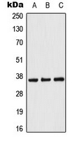 ACOT8 Antibody - Western blot analysis of ACOT8 expression in Raji (A); NIH3T3 (B); PC12 (C) whole cell lysates.