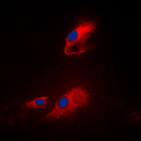 ACOT8 Antibody - Immunofluorescent analysis of ACOT8 staining in Raji cells. Formalin-fixed cells were permeabilized with 0.1% Triton X-100 in TBS for 5-10 minutes and blocked with 3% BSA-PBS for 30 minutes at room temperature. Cells were probed with the primary antibody in 3% BSA-PBS and incubated overnight at 4 C in a humidified chamber. Cells were washed with PBST and incubated with a DyLight 594-conjugated secondary antibody (red) in PBS at room temperature in the dark. DAPI was used to stain the cell nuclei (blue).