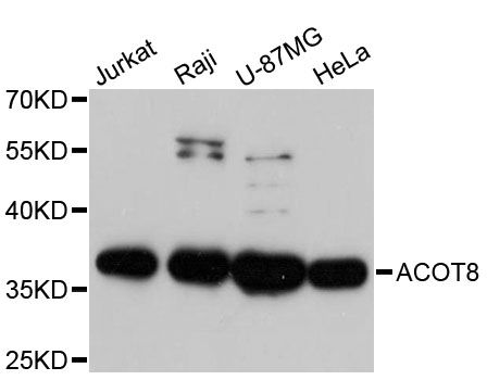 ACOT8 Antibody - Western blot analysis of extracts of various cell lines, using ACOT8 antibody at 1:3000 dilution. The secondary antibody used was an HRP Goat Anti-Rabbit IgG (H+L) at 1:10000 dilution. Lysates were loaded 25ug per lane and 3% nonfat dry milk in TBST was used for blocking. An ECL Kit was used for detection and the exposure time was 30s.