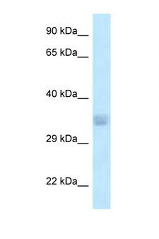 ACOT8 Antibody - ACOT8 antibody Western blot of 721_B Cell lysate. Antibody concentration 1 ug/ml.  This image was taken for the unconjugated form of this product. Other forms have not been tested.