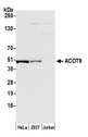 ACOT9 Antibody - Detection of human ACOT9 by western blot. Samples: Whole cell lysate (50 µg) from HeLa, HEK293T, and Jurkat cells prepared using NETN lysis buffer. Antibody: Affinity purified rabbit anti-ACOT9 antibody used for WB at 1:1000. Detection: Chemiluminescence with an exposure time of 30 seconds.