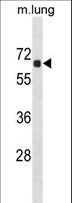 ACOT9 Antibody - ACOT9 Antibody western blot of mouse lung tissue lysates (35 ug/lane). The ACOT9 antibody detected the ACOT9 protein (arrow).